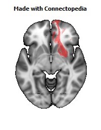 Uncinate_fasciculus_R114