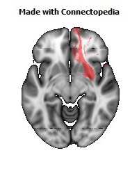 Uncinate_fasciculus_R116