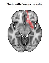 Uncinate_fasciculus_R118