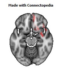 Uncinate_fasciculus_R122