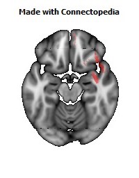 Uncinate_fasciculus_R124