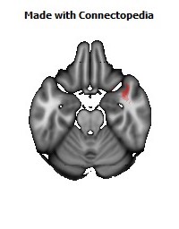 Uncinate_fasciculus_R130