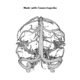 Superficial Middle Cerebral Vein