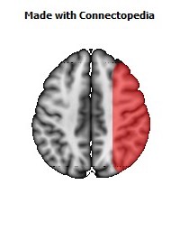 Vein_Superficial_Middle_Cerebral_R064