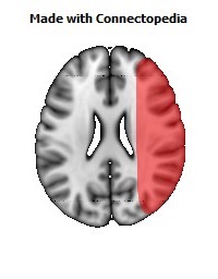 Vein_Superficial_Middle_Cerebral_R084