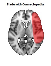 Vein_Superficial_Middle_Cerebral_R102