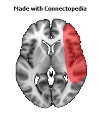 Vein_Superficial_Middle_Cerebral_R104