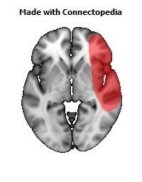 Vein_Superficial_Middle_Cerebral_R110