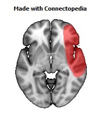 Vein_Superficial_Middle_Cerebral_R112