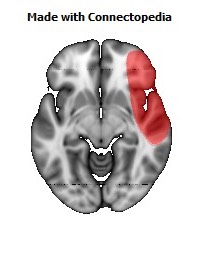 Vein_Superficial_Middle_Cerebral_R116