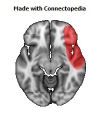 Vein_Superficial_Middle_Cerebral_R118