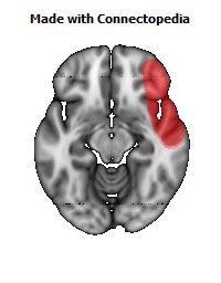 Vein_Superficial_Middle_Cerebral_R120