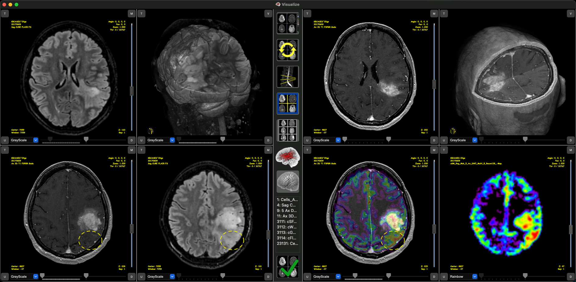 Manager & Visualize Tumor